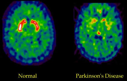 Change brain efficiency